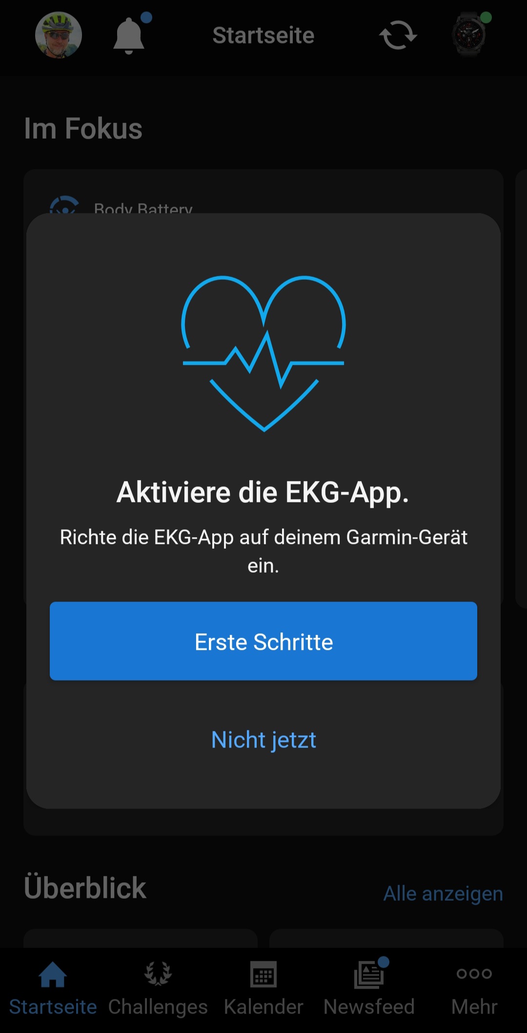 svg+xml,%3Csvg%20xmlns= Garmin EKG-Aufzeichnung